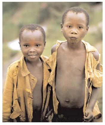 Children between 10–19 years of age face serious nutritional deficiencies worldwide, according to the World Health Organization. About 1,200 million, or 19 percent of adolescents suffer from poor nutrition that hurts their development and growth. [Photograph by Jason Laure. Reproduced by permission.]