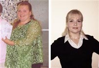 Photos of Donna - Before and After
